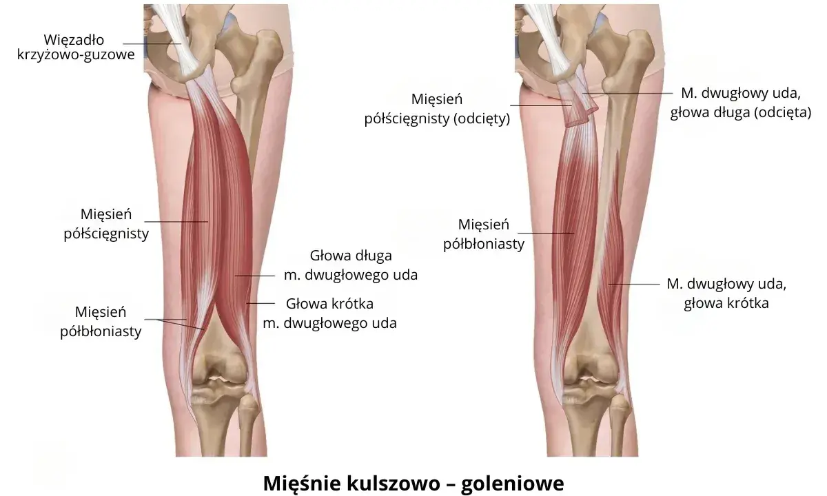 Anatomia mięśni kończyny dolnej: mięsień półścięgnisty i półbłoniasty, głowy mięśnia dwugłowego uda.