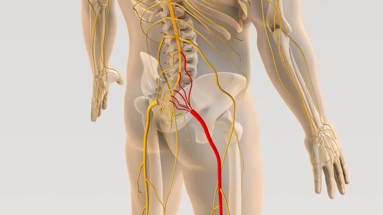 Anatomia układu nerwowego, z czerwonym wyróżnieniem nerwu biegnącego od kręgosłupa do nogi, sugerującym zapalenie powięzi kręgosłupa.