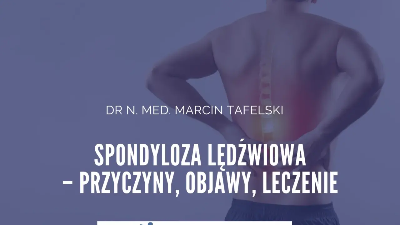 Ból pleców? Dowiedz się o spondylozie lędźwiowej: przyczyny, objawy i skuteczne leczenie. Dr n. med. Marcin Tafelski.