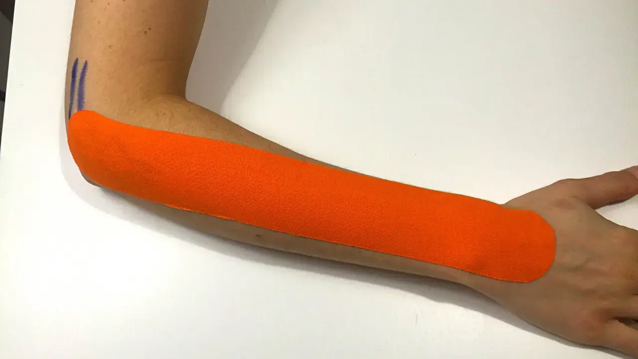 Pomarańczowy plaster kinezjotaping na przedramieniu, wspierający leczenie łokcia tenisisty. Fizjoterapia w działaniu.