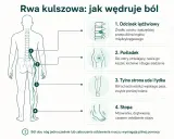 Ilustracja pokazuje, jak ból rwy kulszowej promieniuje od odcinka lędźwiowego przez pośladek, udo, łydkę aż do stopy. To klucz do zrozumienia najskuteczniejszej metody na rwę kulszową.
