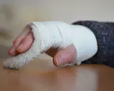 Dłoń w bandażu, z widocznymi palcami. Zastanawiasz się, jak długo trwa rehabilitacja po złamaniu nadgarstka?