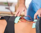 Fizjoterapeuta podłącza elektrody do pacjenta, rozpoczynając zabieg galwanizacji.