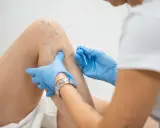 Igłoterapia kolana: specjalista w niebieskich rękawiczkach aplikuje igły. Ile zabiegów potrzeba do ulgi?