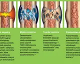 Ilustracja pokazuje etapy zrastania się kości: stan zapalny, miękką i twardą kostninę, aż do przebudowy kości.