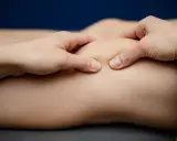 Fizjoterapeuta wykonuje masaż stawu kolanowego, pomagając w leczeniu chondromalacji rzepki. Ćwiczenia wzmacniające są kluczowe.