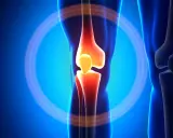 Anatomia kolana z zaznaczonym bólem, sugerującym zerwanie ACL.