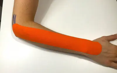 Pomarańczowy plaster kinezjotaping na przedramieniu, wspierający leczenie łokcia tenisisty. Fizjoterapia w działaniu.