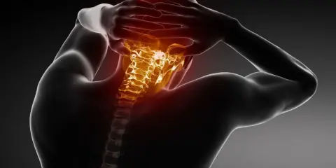 Ból głowy i szyi, objawy skręcenia i naderwania odcinka szyjnego kręgosłupa.