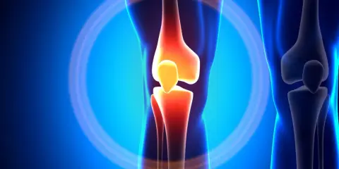 Anatomia kolana z zaznaczonym bólem, sugerującym zerwanie ACL.