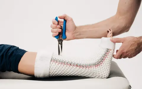 Lekarz zdejmuje gips z nogi pacjenta, przygotowując do zmiany na ortezę. Po jakim czasie można zmienić gips na ortezę?