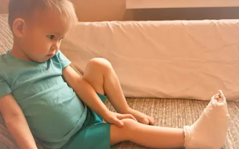 Smutny chłopiec z gipsem na nodze po skręceniu kostki. Jak długo nie można chodzić po urazie?