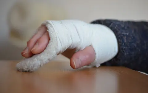 Dłoń w bandażu, z widocznymi palcami. Zastanawiasz się, jak długo trwa rehabilitacja po złamaniu nadgarstka?