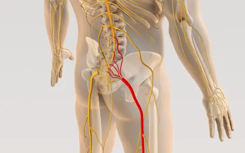 Anatomia układu nerwowego, z czerwonym wyróżnieniem nerwu biegnącego od kręgosłupa do nogi, sugerującym zapalenie powięzi kręgosłupa.