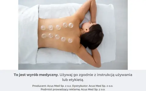 Kobieta z bańkami na plecach. Stawia się je, by wspomóc regenerację i złagodzić napięcie mięśniowe.