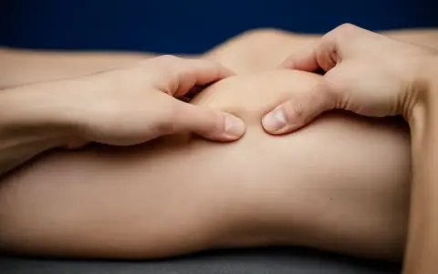 Fizjoterapeuta wykonuje masaż stawu kolanowego, pomagając w leczeniu chondromalacji rzepki. Ćwiczenia wzmacniające są kluczowe.