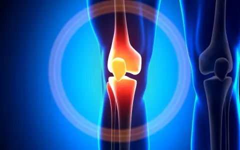 Anatomia kolana z zaznaczonym bólem, sugerującym zerwanie ACL.