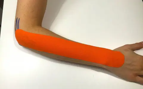 Pomarańczowy plaster kinezjotaping na przedramieniu, wspierający leczenie łokcia tenisisty. Fizjoterapia w działaniu.