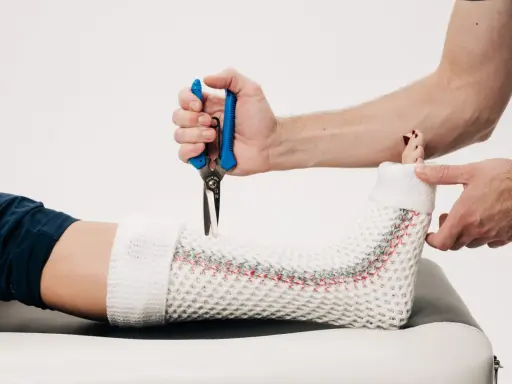 Lekarz zdejmuje gips z nogi pacjenta, przygotowując do zmiany na ortezę. Po jakim czasie można zmienić gips na ortezę?