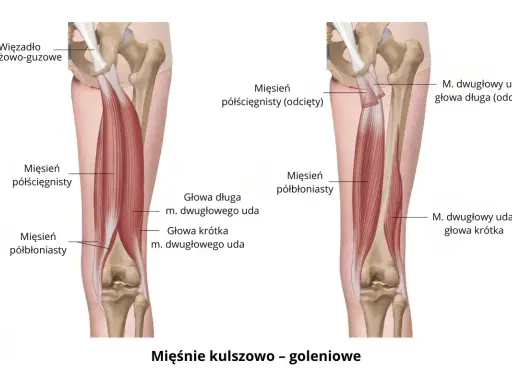 Anatomia mięśni kończyny dolnej: mięsień półścięgnisty i półbłoniasty, głowy mięśnia dwugłowego uda.