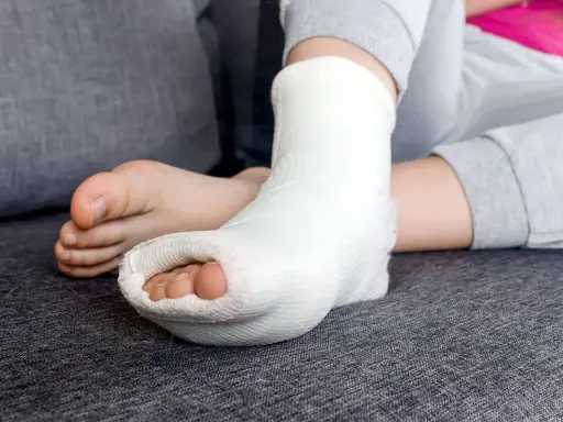 Dziecko z gipsową ortezą na nodze, która właśnie została zdjęta. Palce stopy są widoczne.