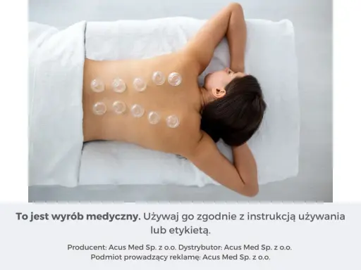 Kobieta z bańkami na plecach. Stawia się je, by wspomóc regenerację i złagodzić napięcie mięśniowe.