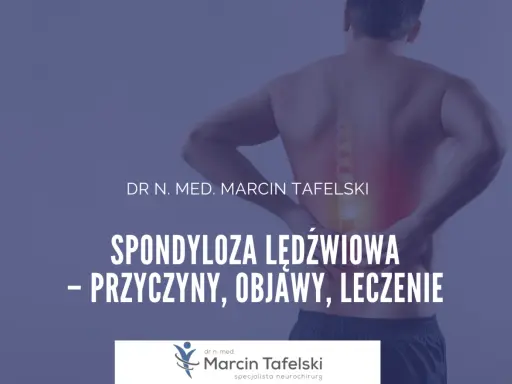 Ból pleców? Dowiedz się o spondylozie lędźwiowej: przyczyny, objawy i skuteczne leczenie. Dr n. med. Marcin Tafelski.