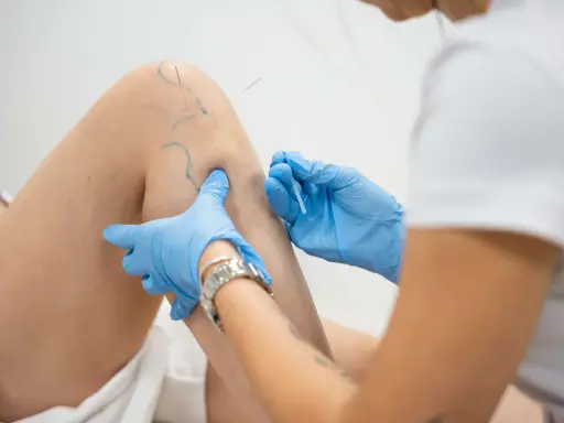 Igłoterapia kolana: specjalista w niebieskich rękawiczkach aplikuje igły. Ile zabiegów potrzeba do ulgi?