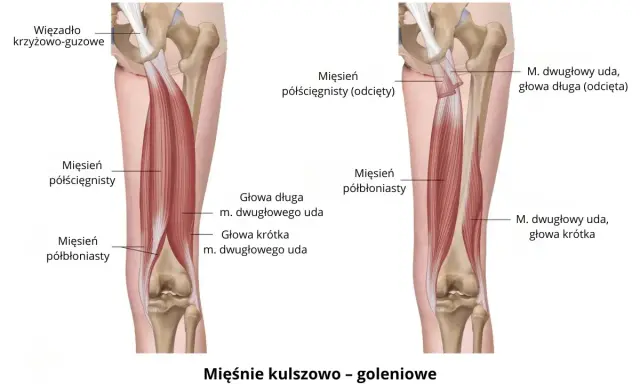 Anatomia mięśni kończyny dolnej: mięsień półścięgnisty i półbłoniasty, głowy mięśnia dwugłowego uda.