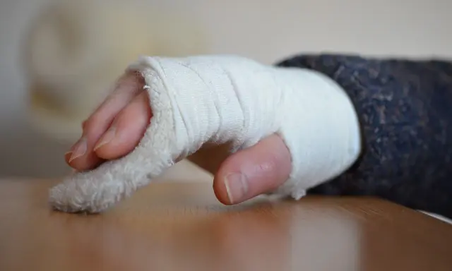 Dłoń w bandażu, z widocznymi palcami. Zastanawiasz się, jak długo trwa rehabilitacja po złamaniu nadgarstka?