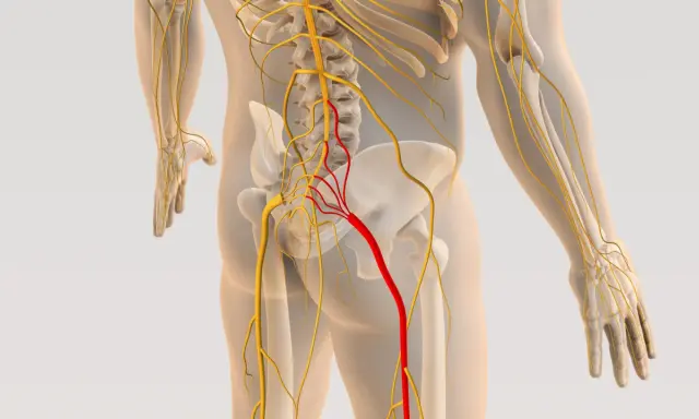 Anatomia układu nerwowego, z czerwonym wyróżnieniem nerwu biegnącego od kręgosłupa do nogi, sugerującym zapalenie powięzi kręgosłupa.