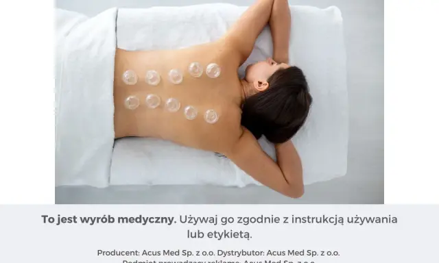 Kobieta z bańkami na plecach. Stawia się je, by wspomóc regenerację i złagodzić napięcie mięśniowe.