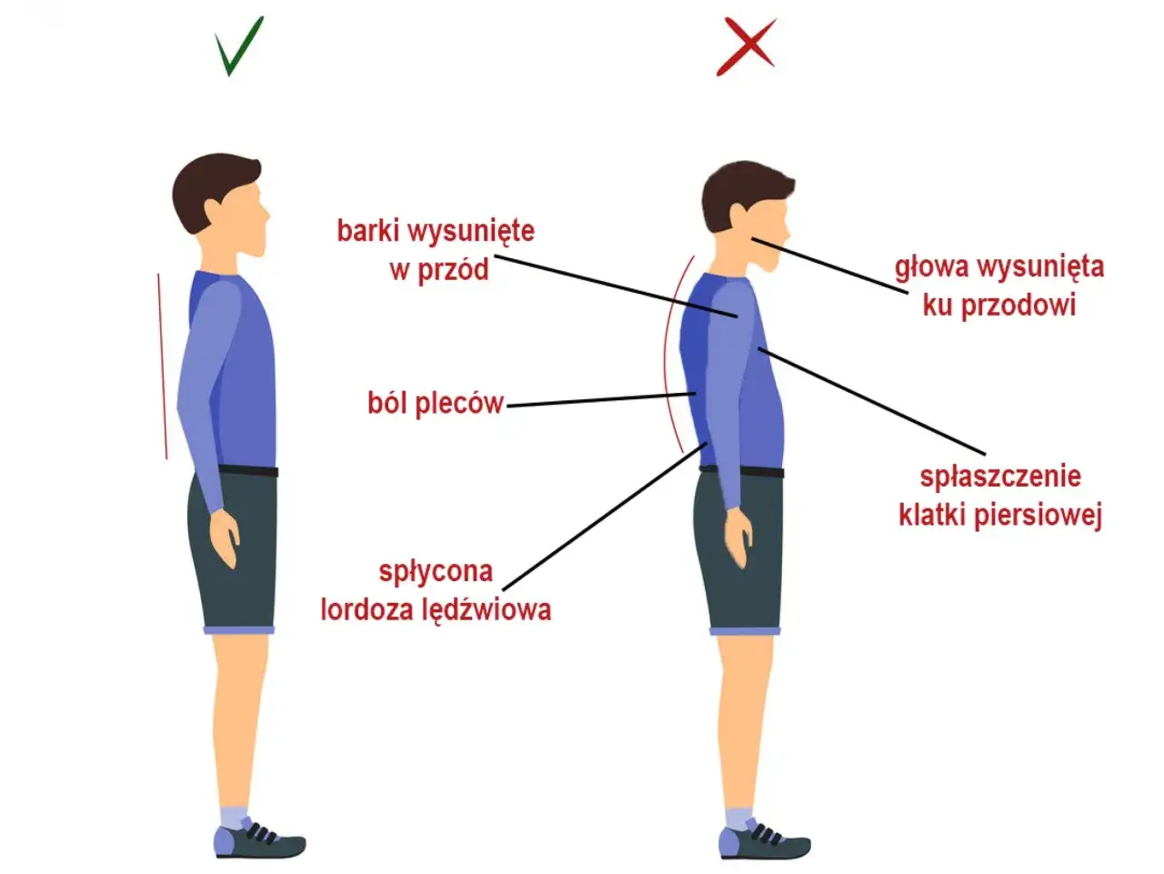 Prawidłowa postawa vs. złe nawyki: zzsk objawy to b&oacute;l plec&oacute;w, wysunięte barki i głowa, spłaszczona klatka piersiowa.