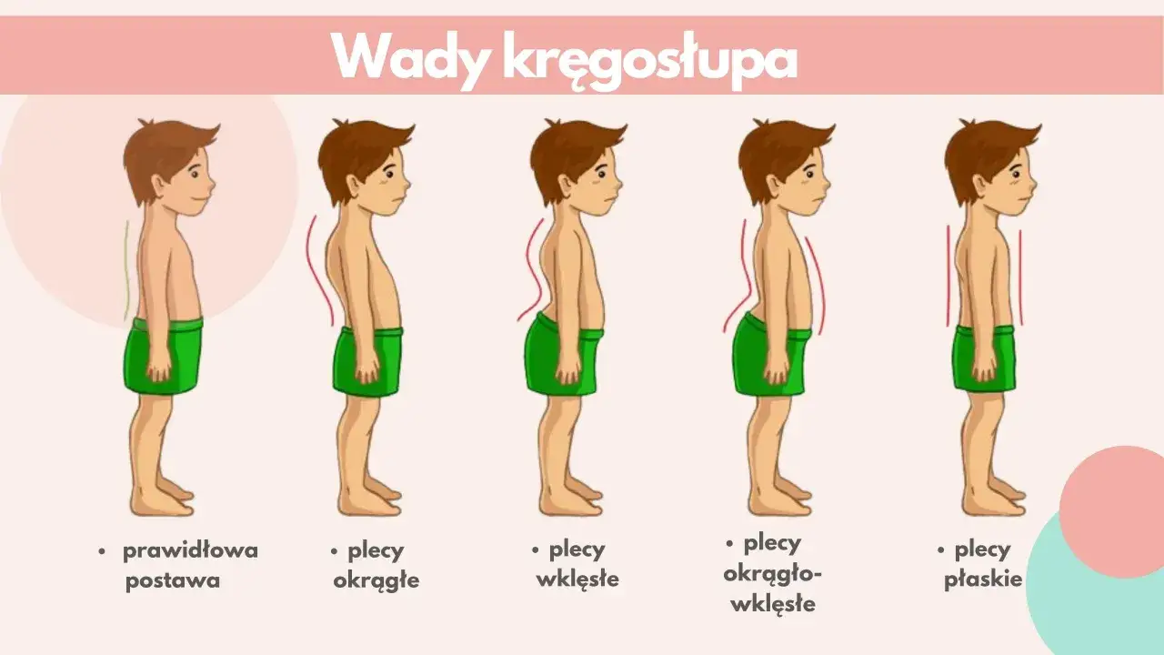 Ilustracja przedstawia pięć sylwetek dzieci z różnymi wadami postawy: prawidłową, plecy okrągłe, wklęsłe, okrągło-wklęsłe i płaskie.