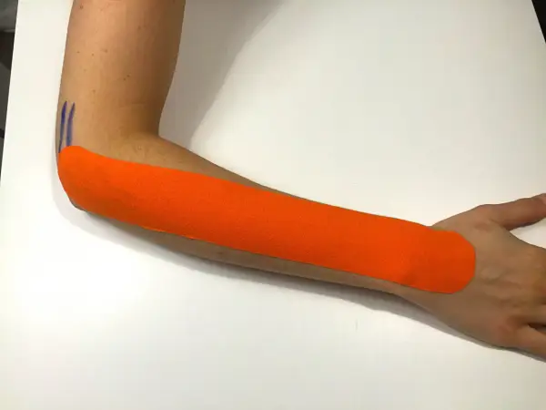 Pomarańczowy plaster kinezjotaping na przedramieniu, wspierający leczenie łokcia tenisisty. Fizjoterapia w działaniu.
